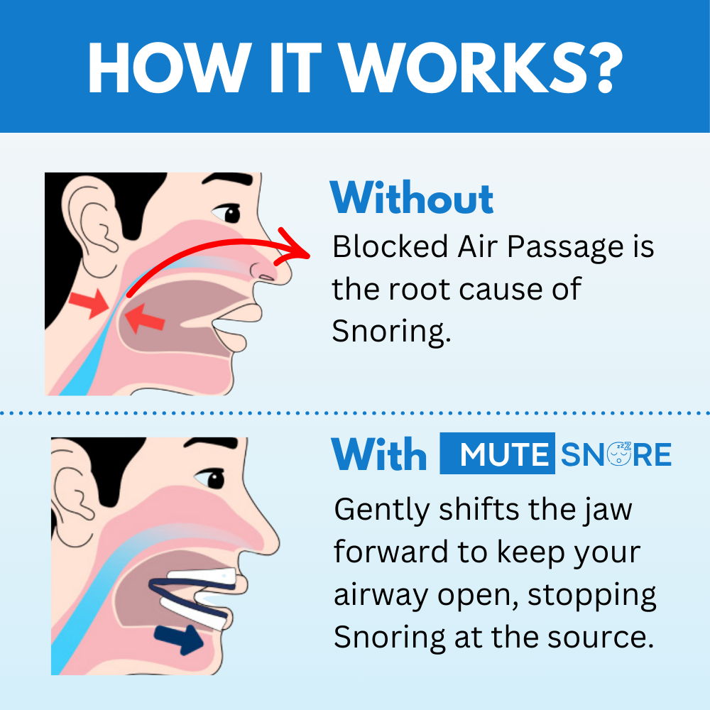 Adjustable Sleep Mouth Guard – Comfortable Night Breathing Support